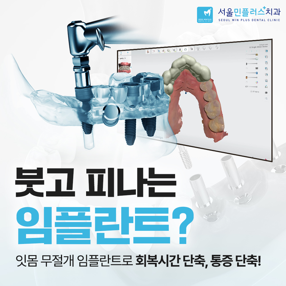 서울민플러스치과의원 대표 이미지