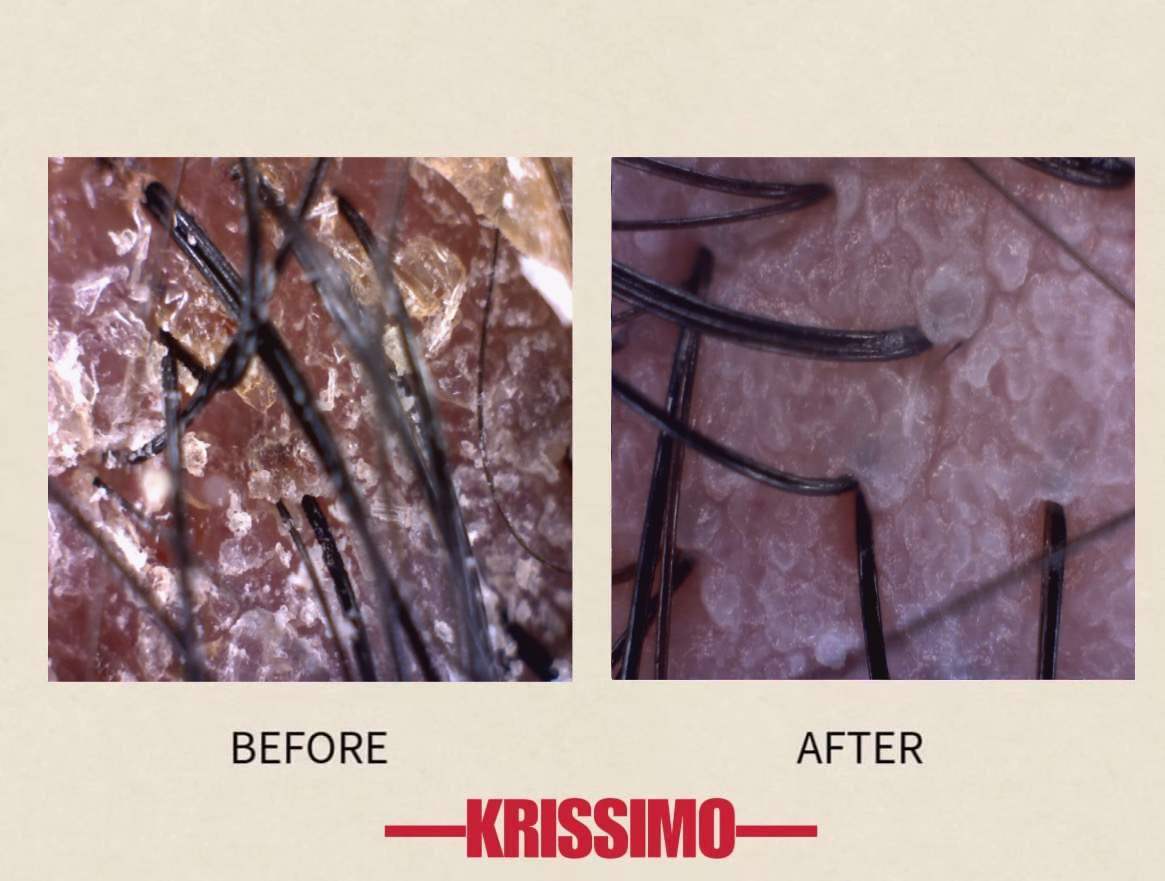 헤드스파 크리시모 대표 이미지