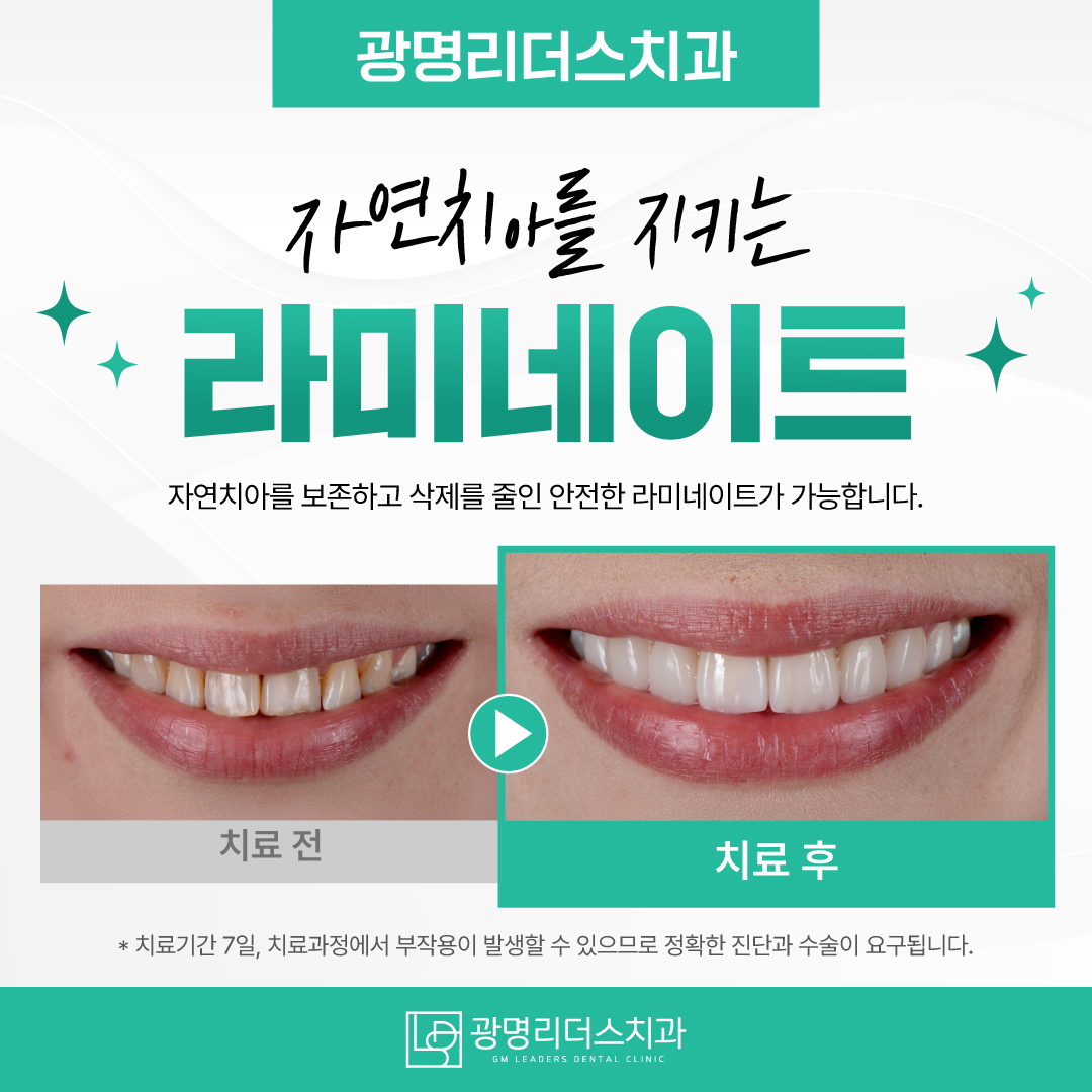 광명리더스치과의원 대표 이미지