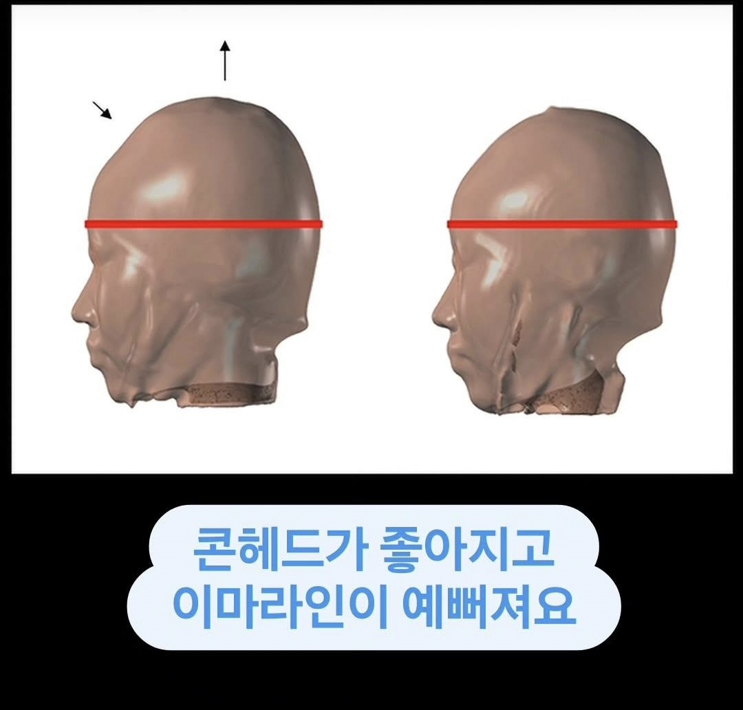 리샘한의원 압구정점 대표 이미지