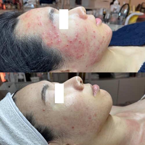 블리아뷰티 대구두류본점 photo 5