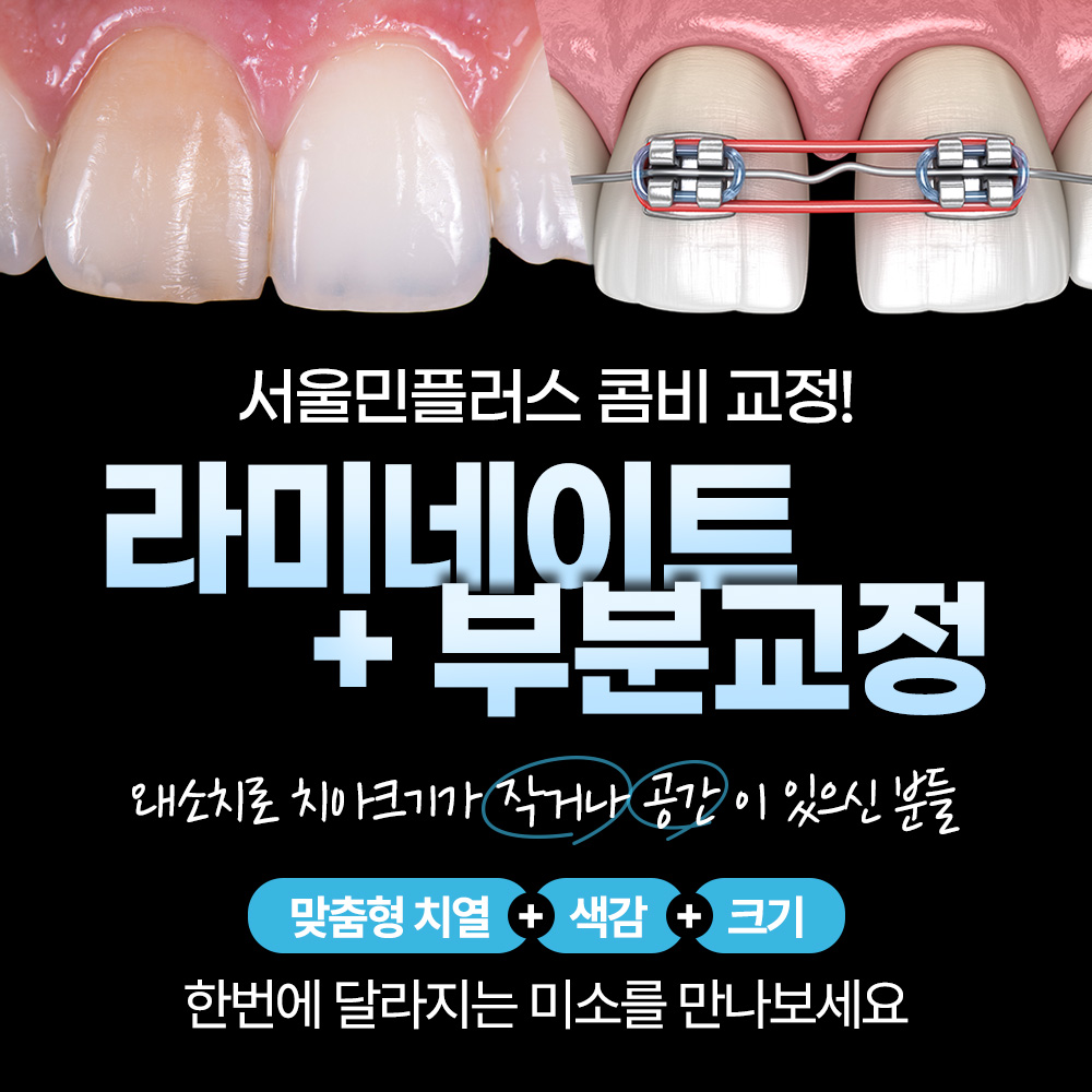 서울민플러스치과의원 수유역점 대표 이미지