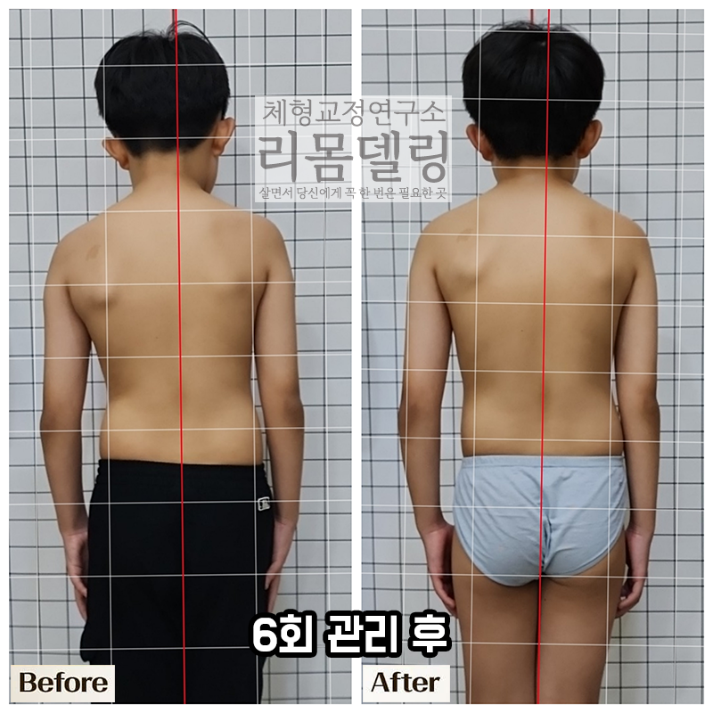 리몸델링체형교정 동탄점 대표 이미지