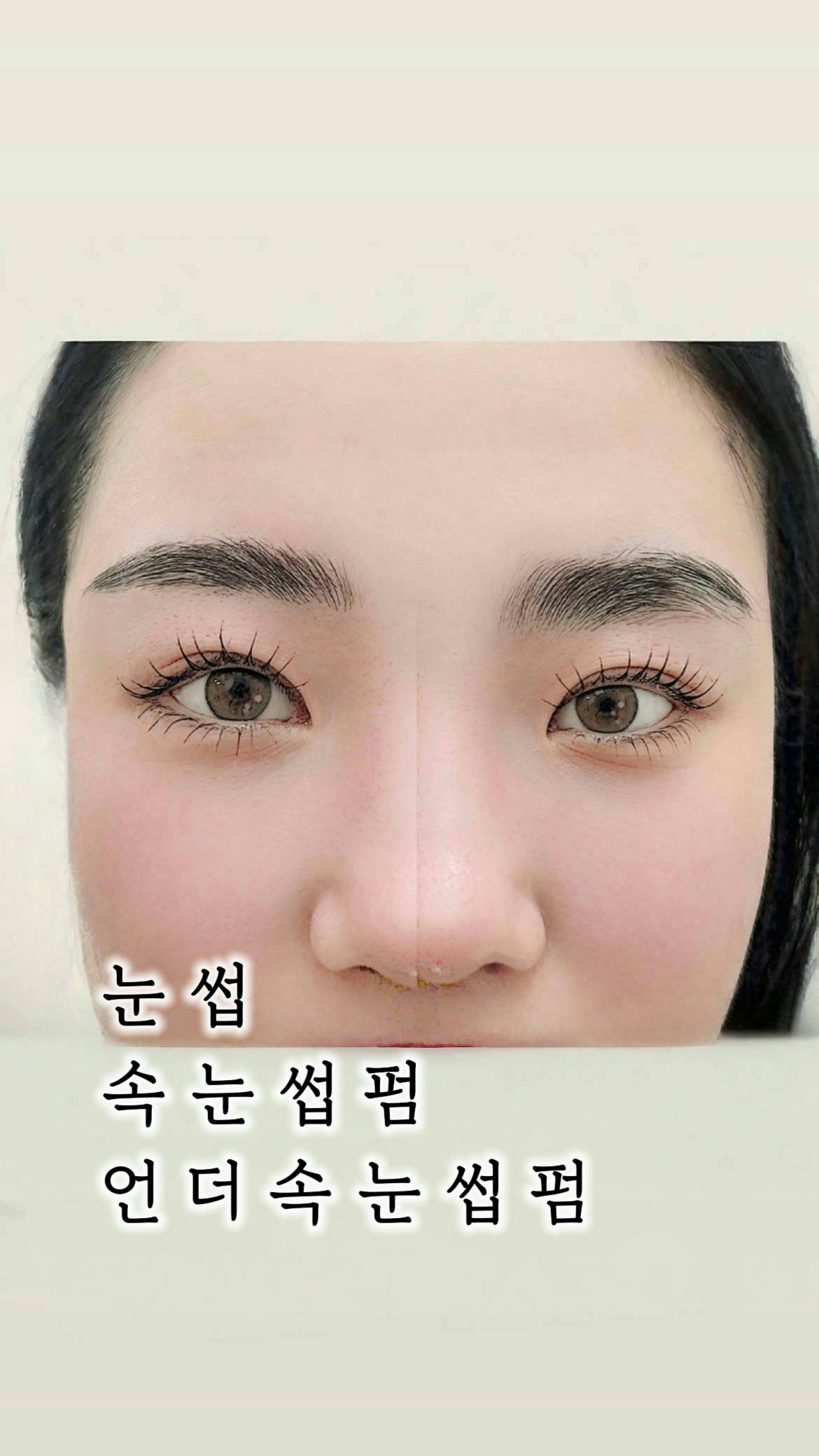 브로아