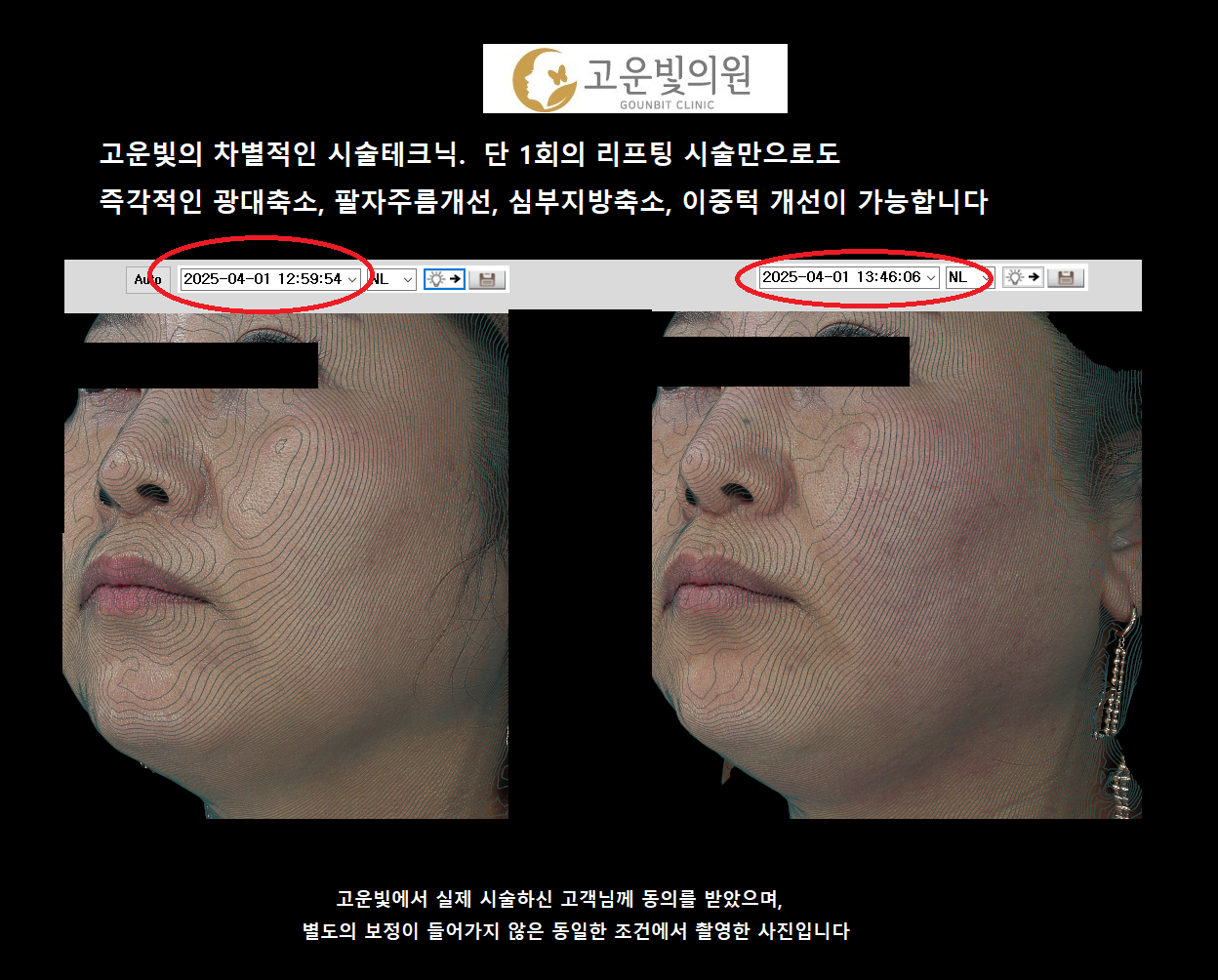 고운빛의원