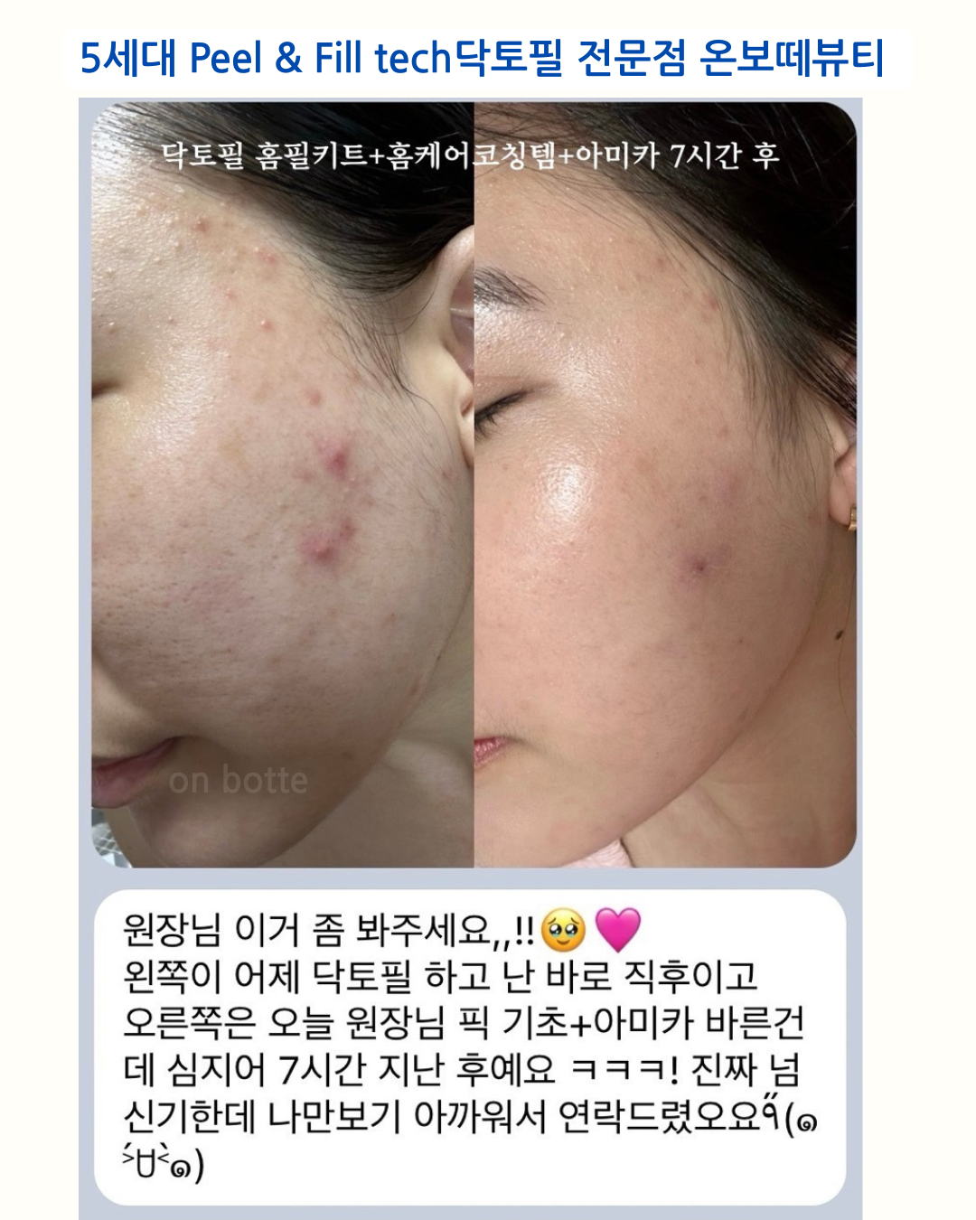 온보떼뷰티 대표 이미지