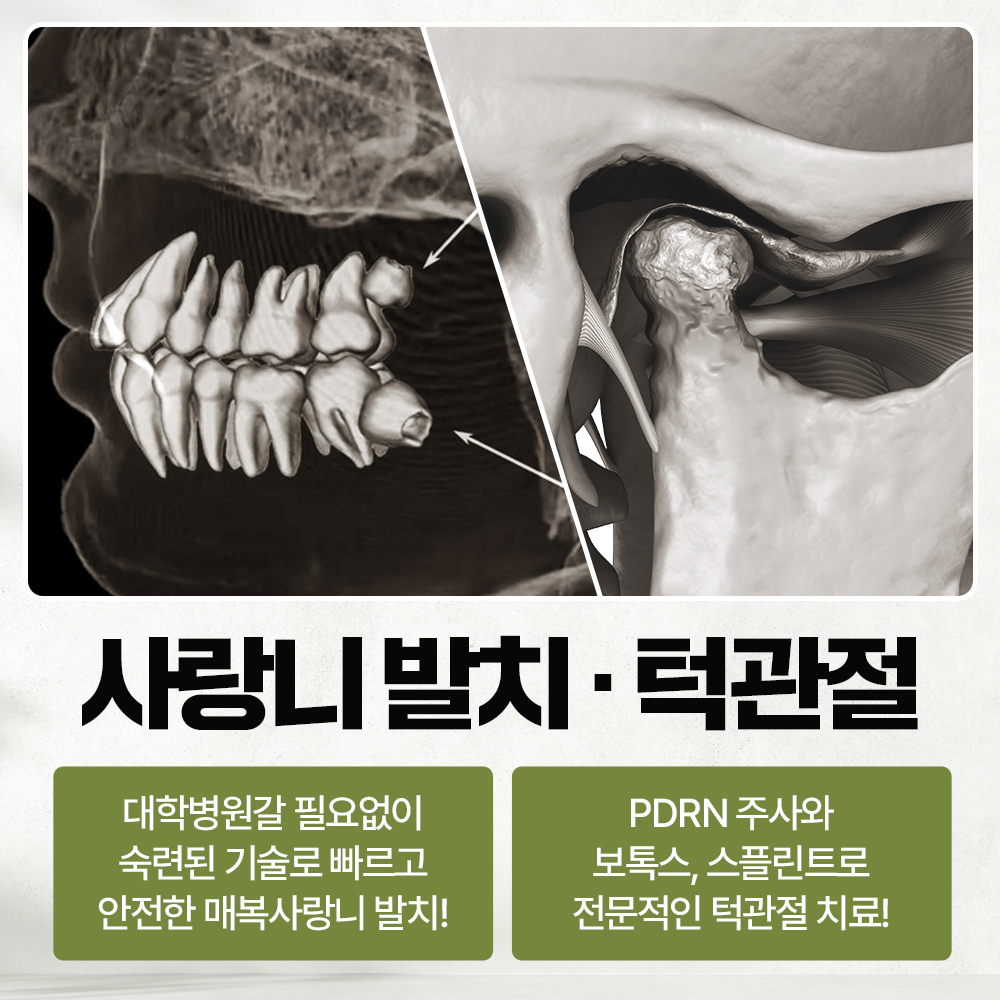 서울올케어치과 대표 이미지
