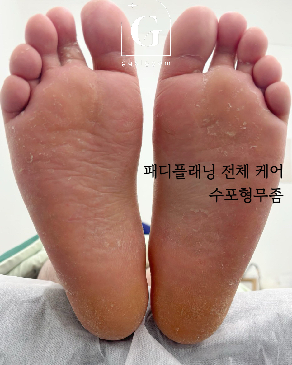 깰꼼 동인점