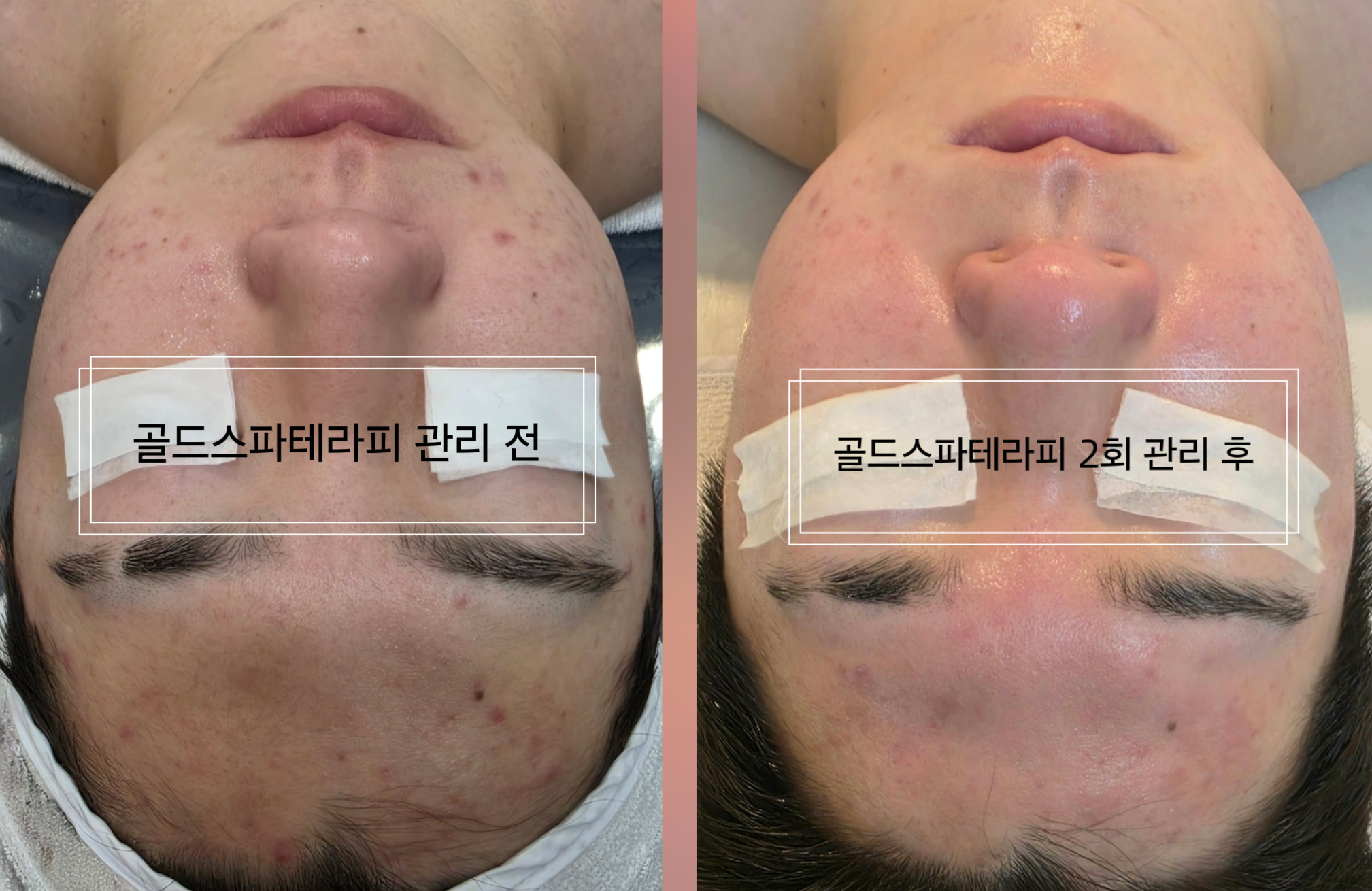 골드스파테라피 마사지 인천부평점 photo 5