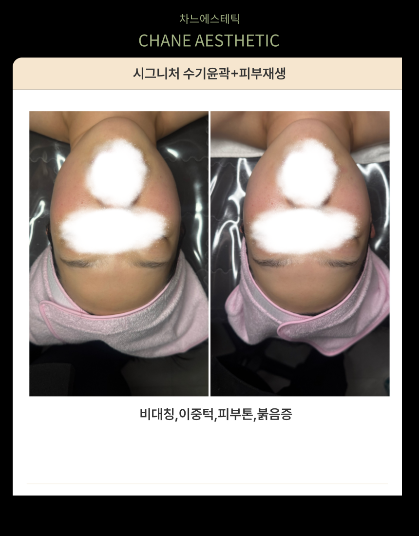 차느에스테틱 월산점 대표 이미지