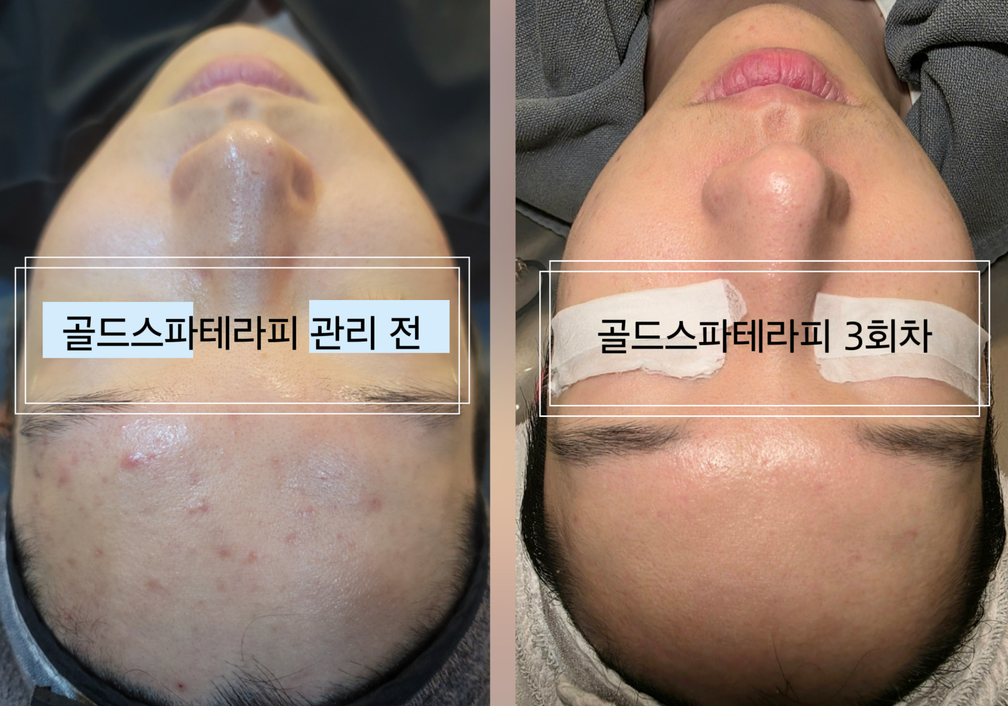 골드스파테라피 마사지 인천부평점 photo 4