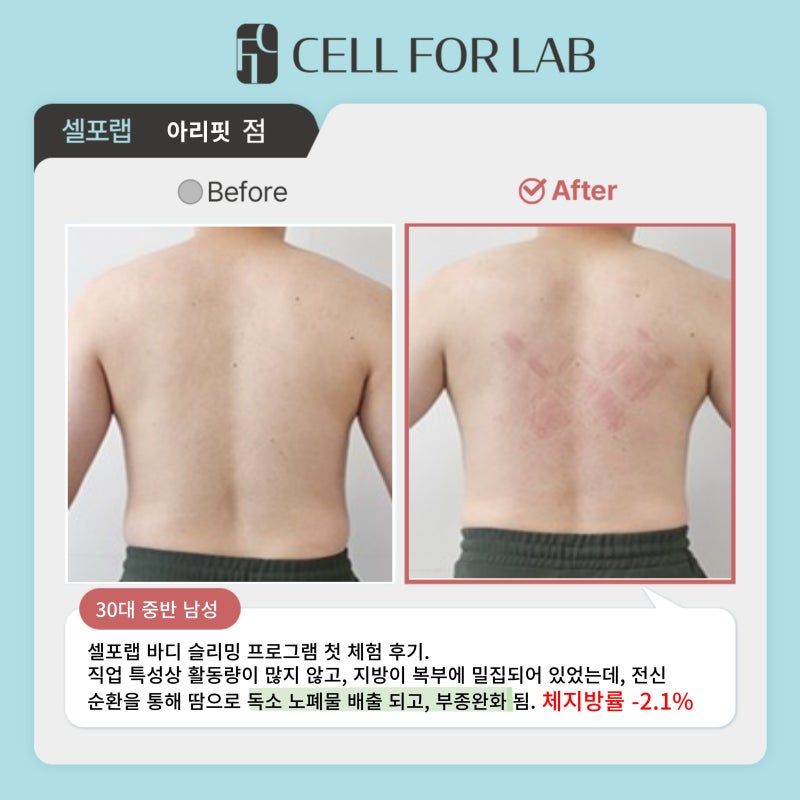 셀포랩 아리핏 photo 2