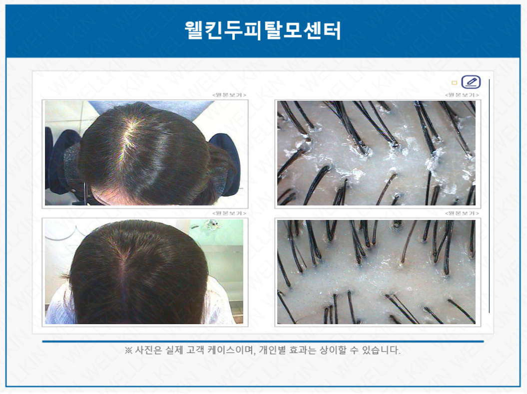 웰킨두피탈모센터