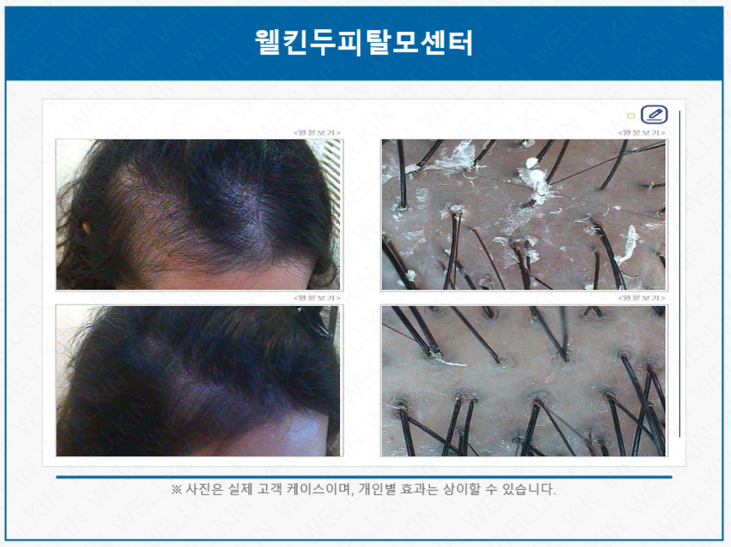 웰킨두피탈모센터 인천청라점 대표 이미지