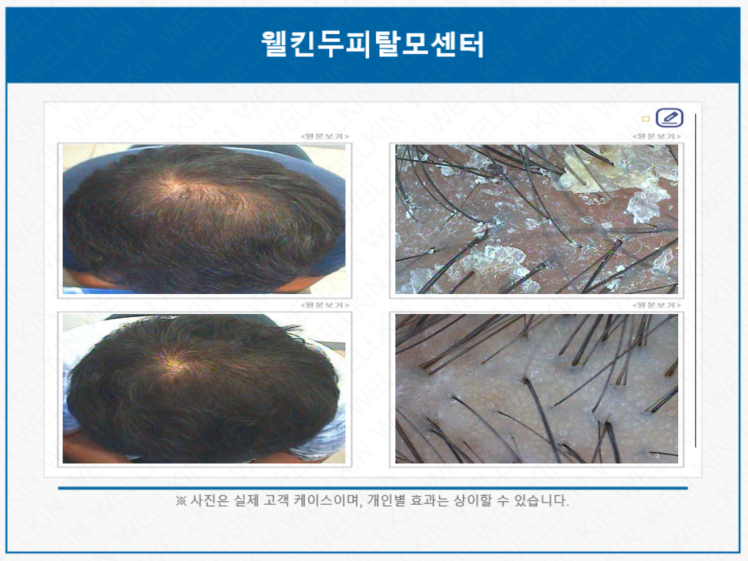 웰킨두피탈모센터 청량리점