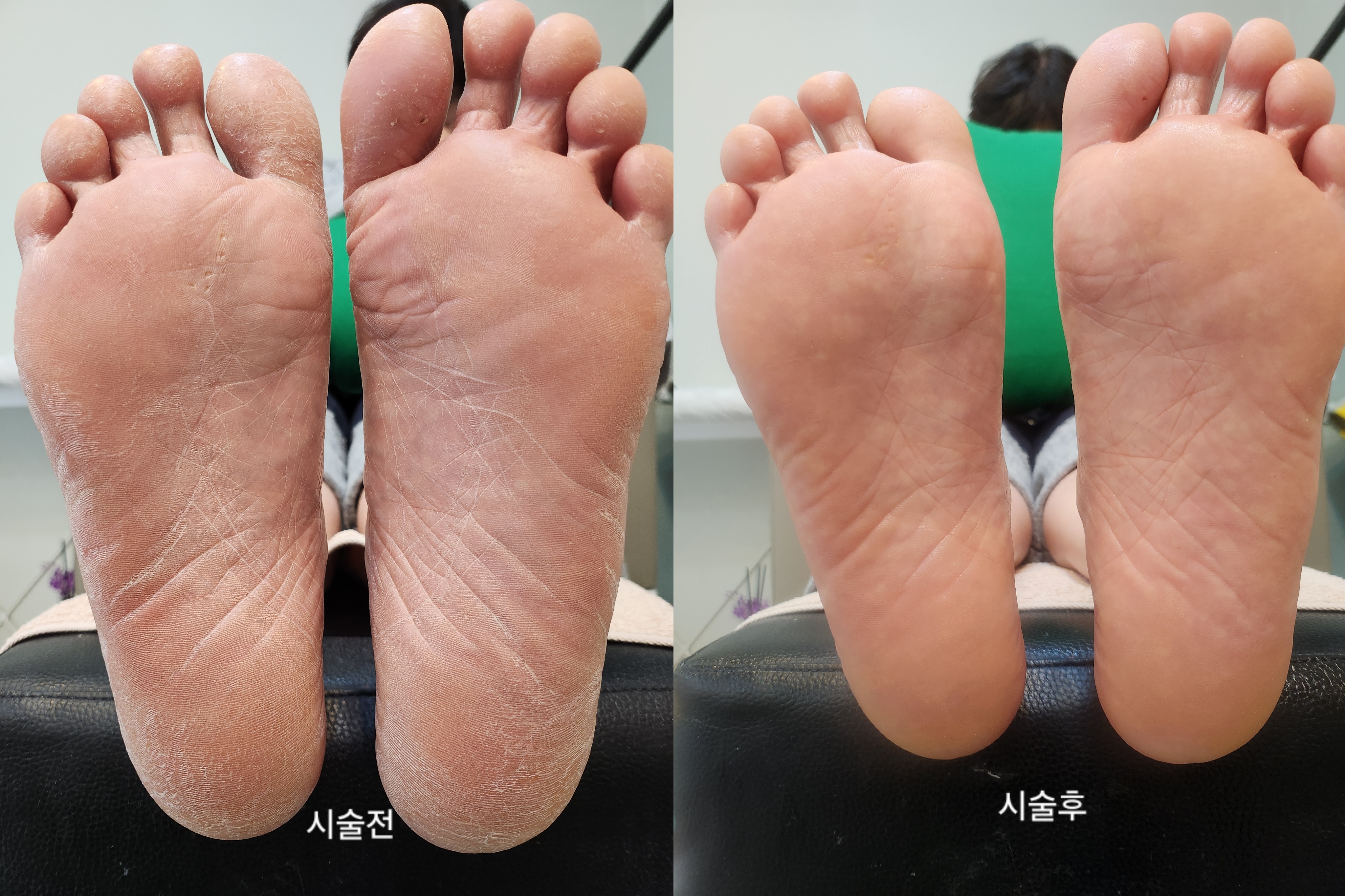 이코뷰티 대표 이미지