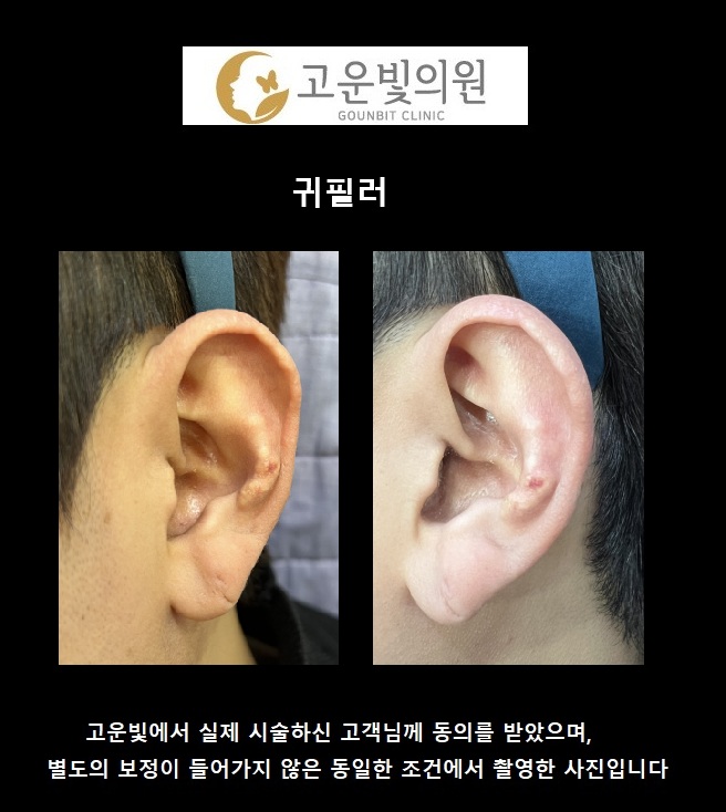 고운빛의원