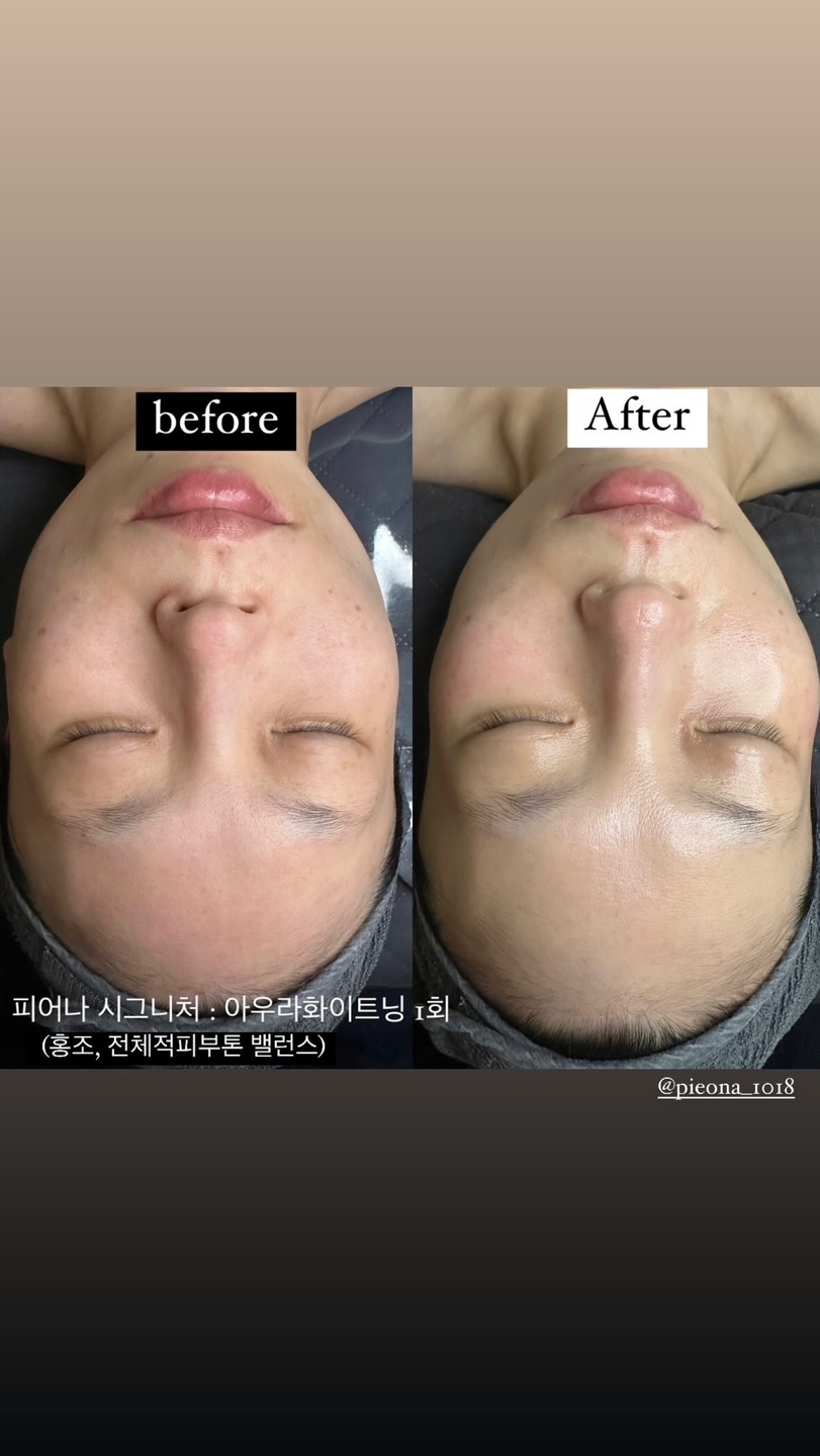 피어나 photo 5