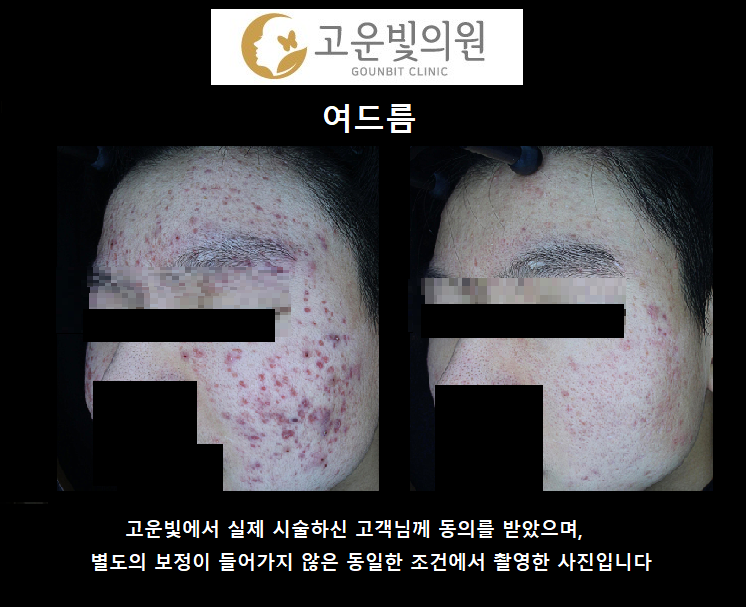 고운빛의원