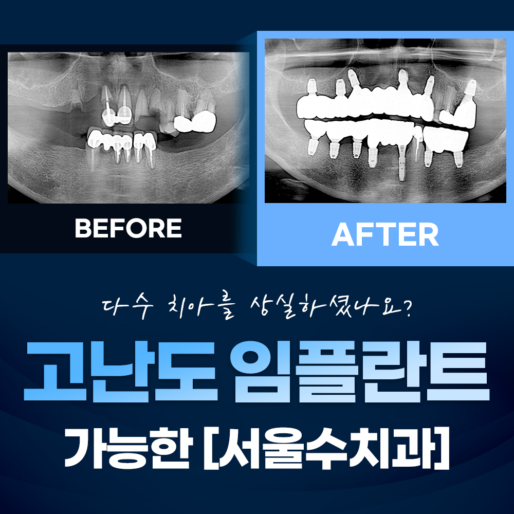 서울수치과의원 대표 이미지