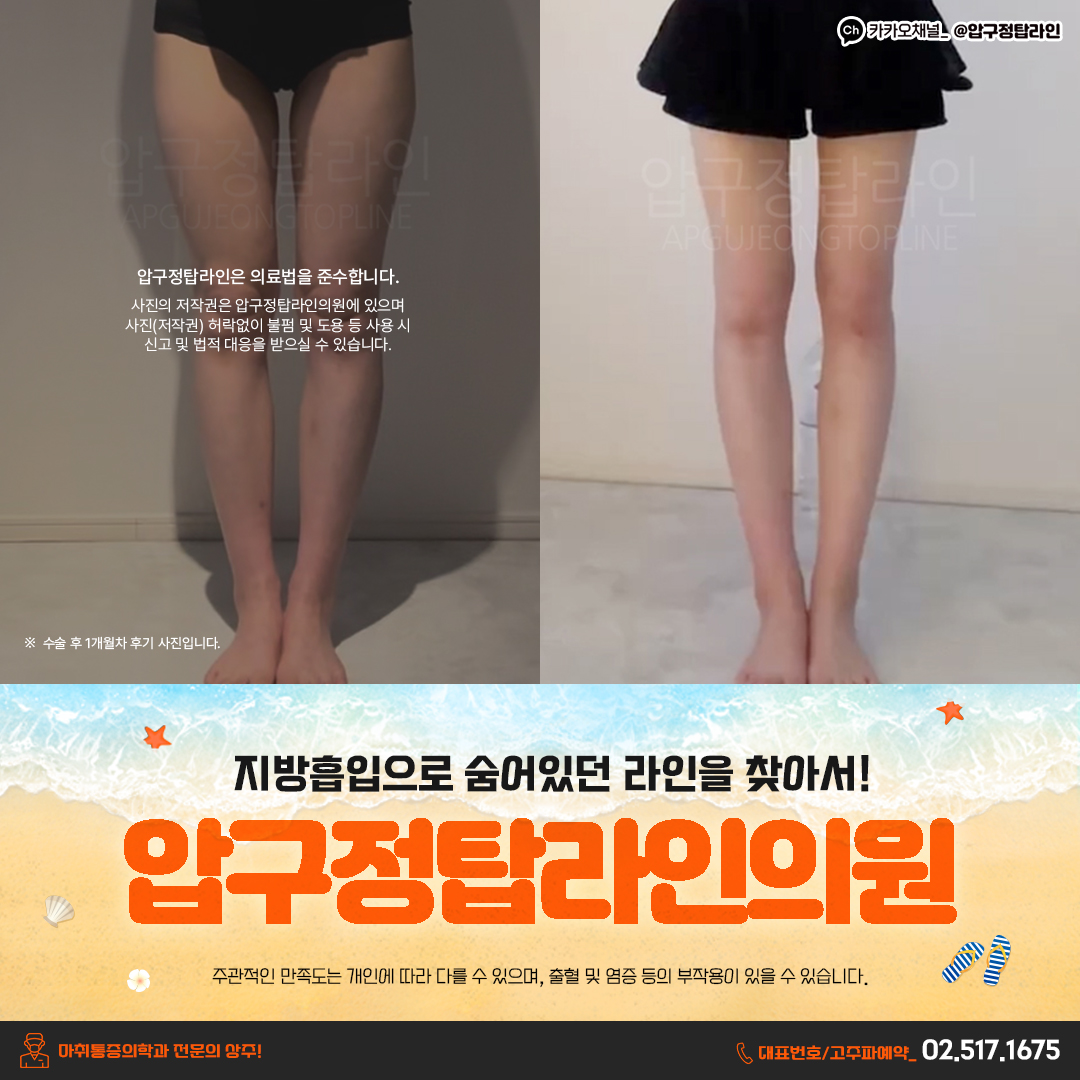 압구정탑라인의원 대표 이미지