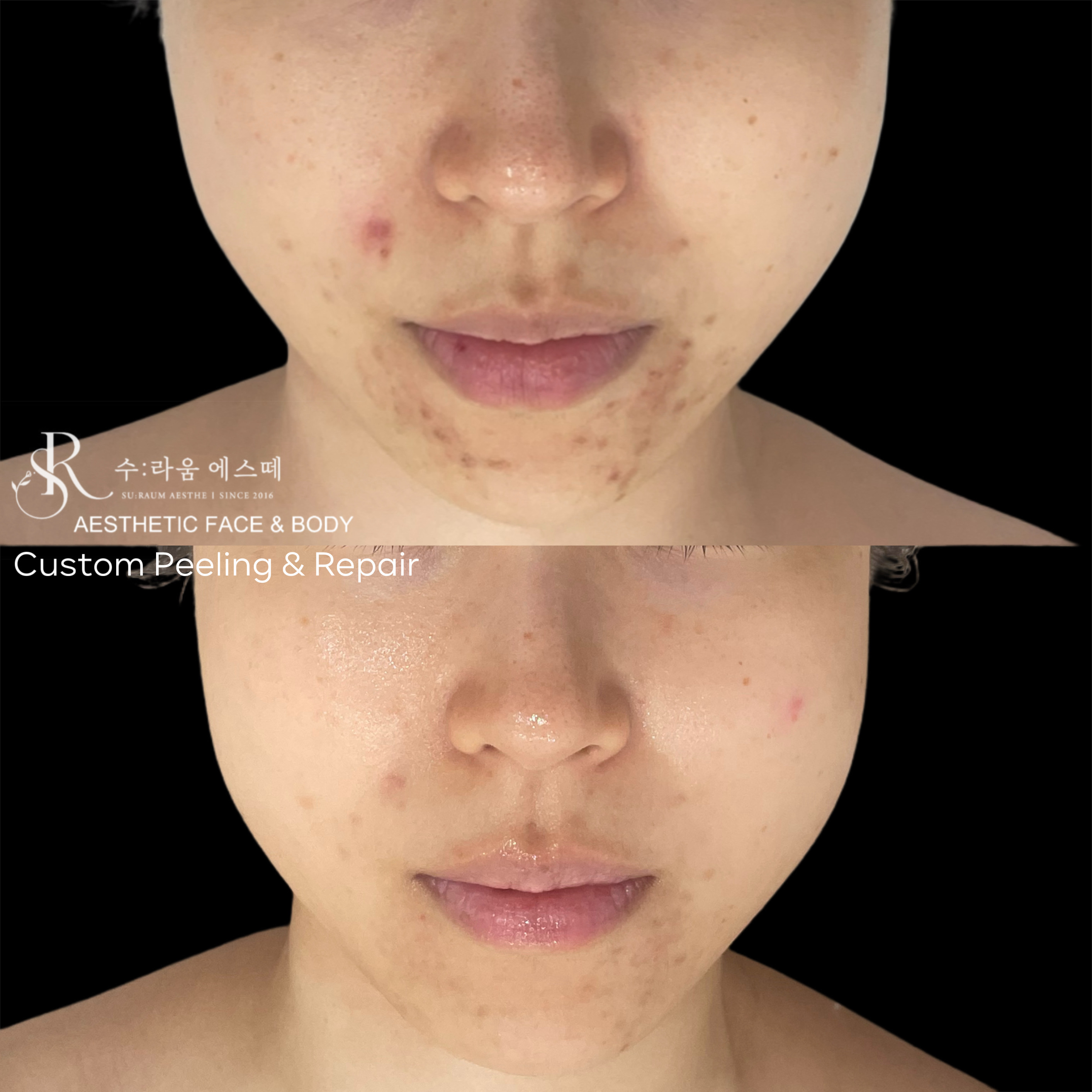 수라움에스떼 대표 이미지