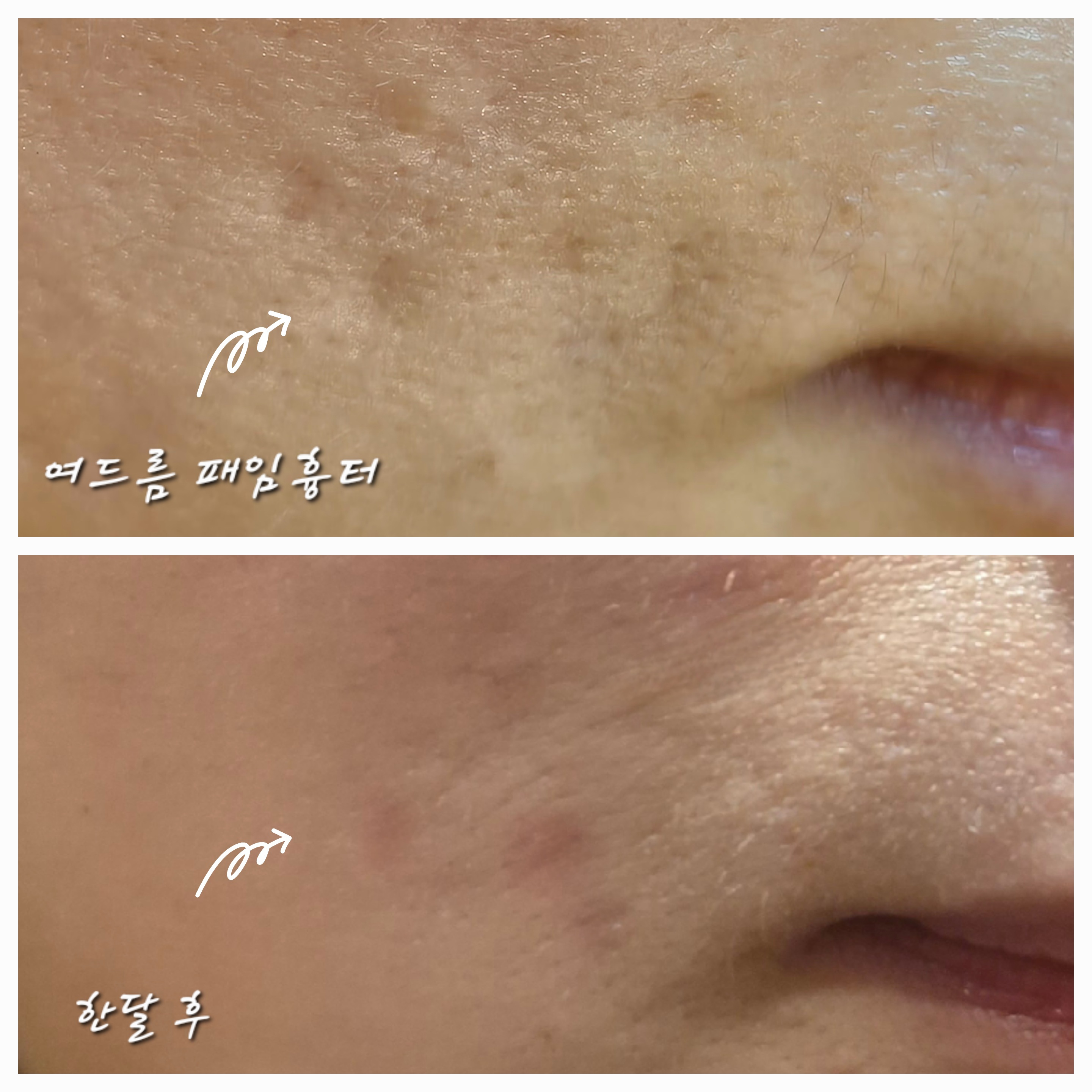 고원장의모공세척테라피 분당점 대표 이미지