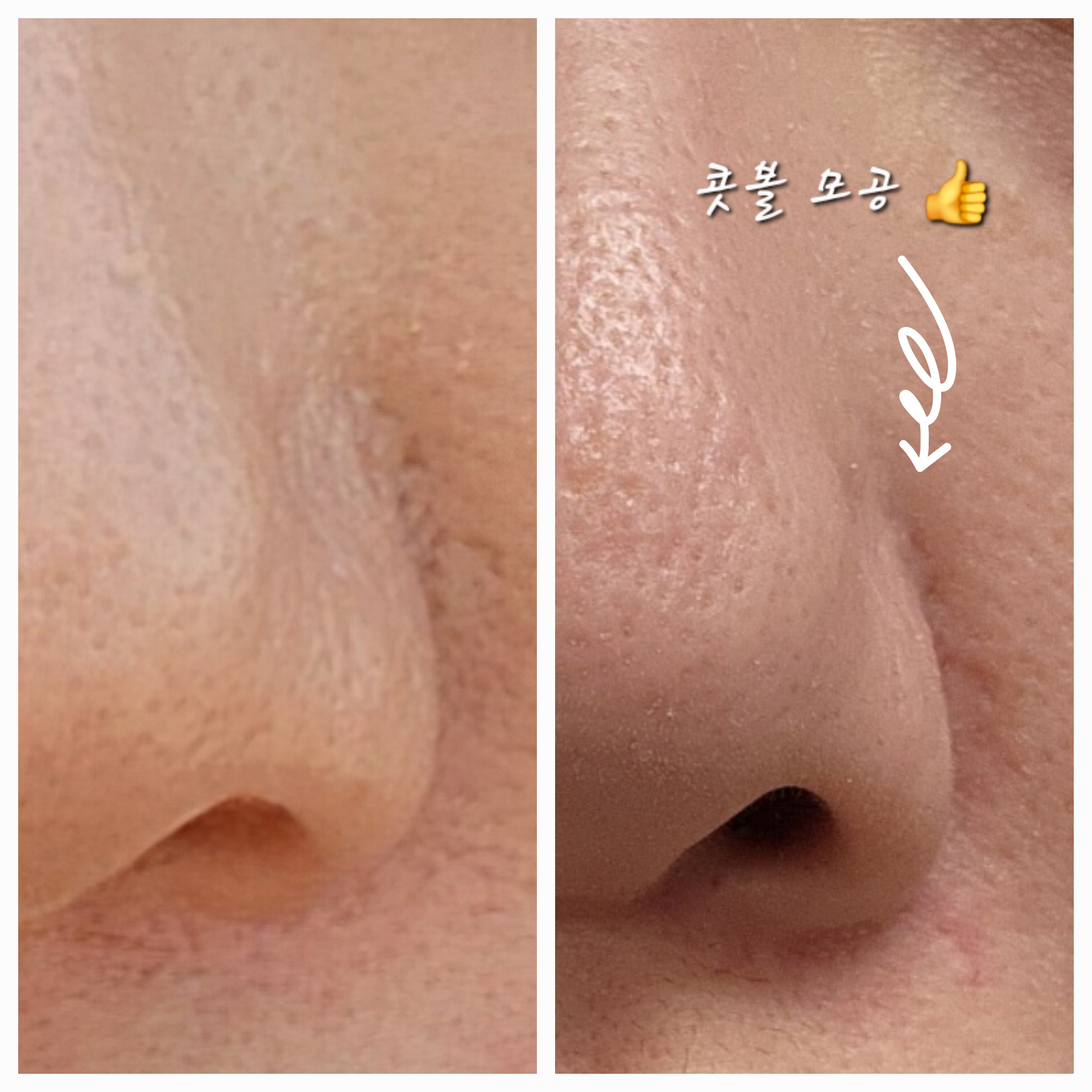 고원장의모공세척테라피 분당점 대표 이미지
