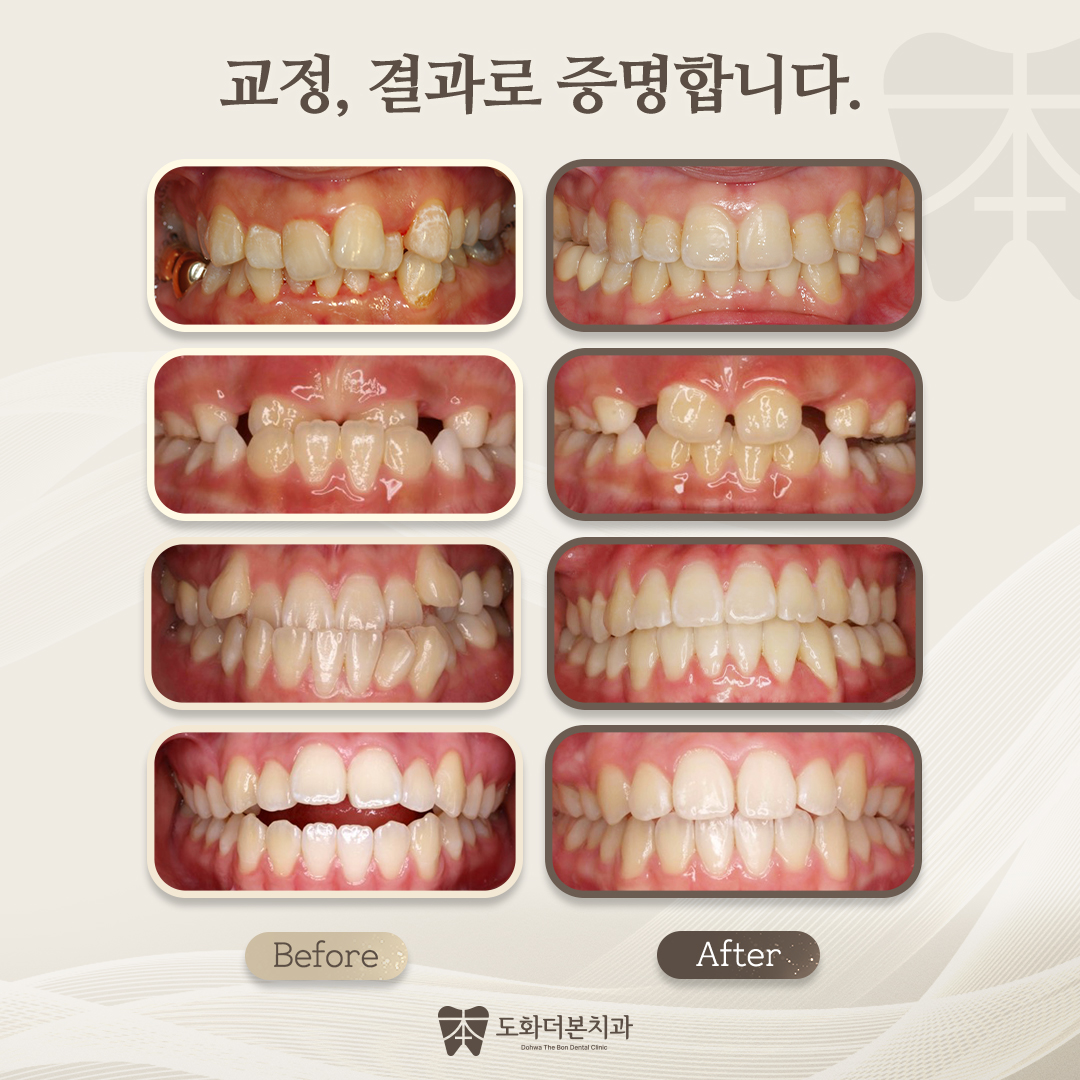 도화더본치과의원 대표 이미지