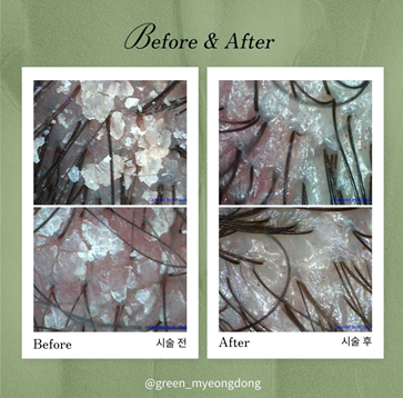 그린두피탈모센터 명동점 대표 이미지