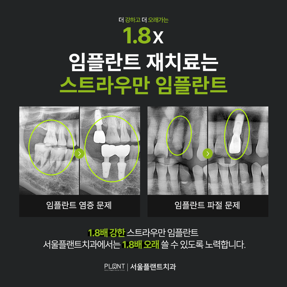 서울플랜트치과의원 대표 이미지
