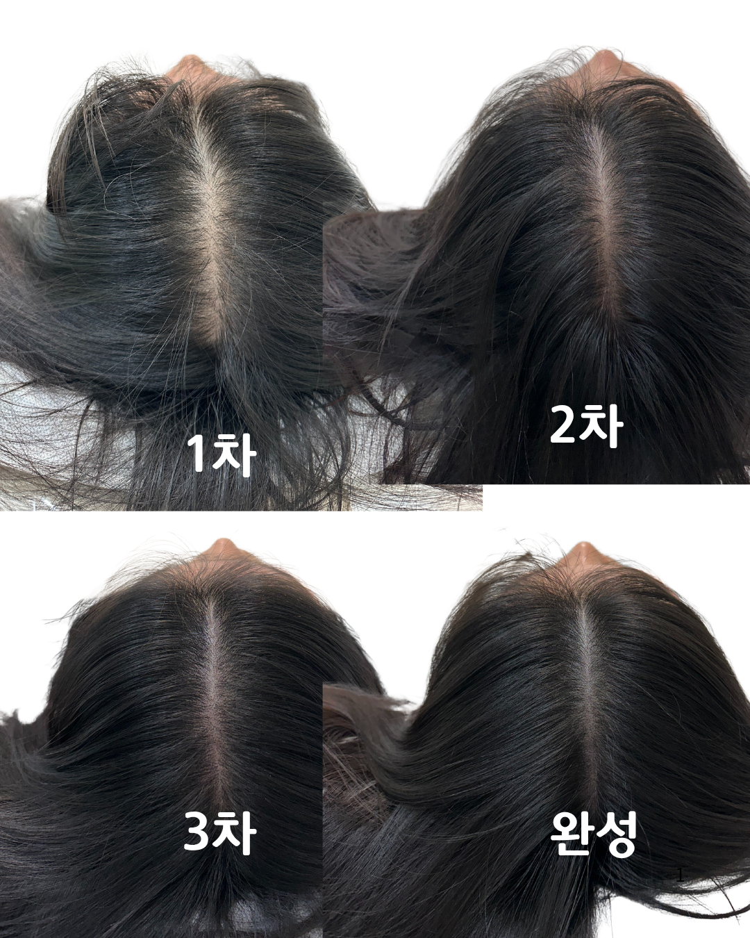 쓰담스칼프 대표 이미지