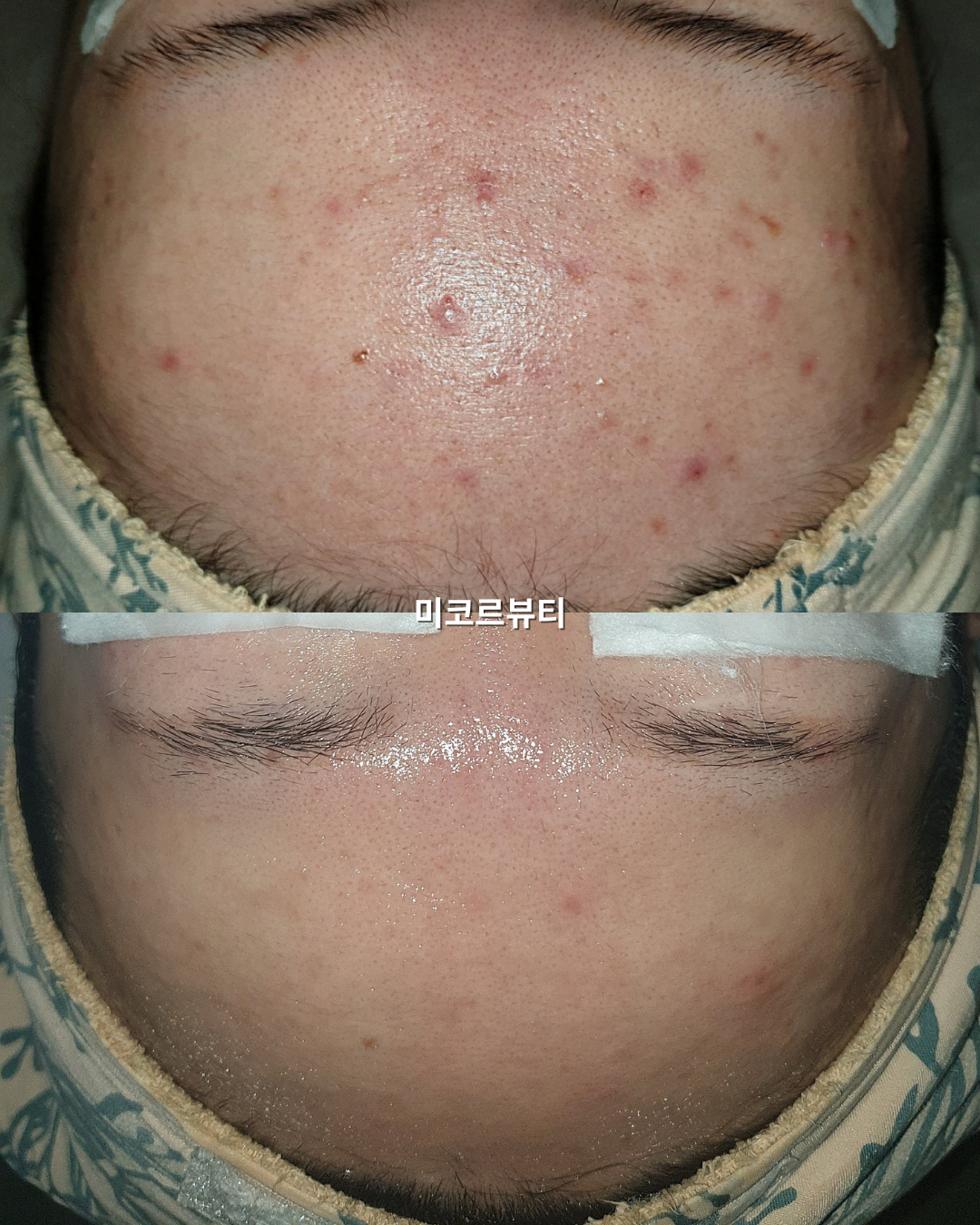 미코르뷰티 대표 이미지