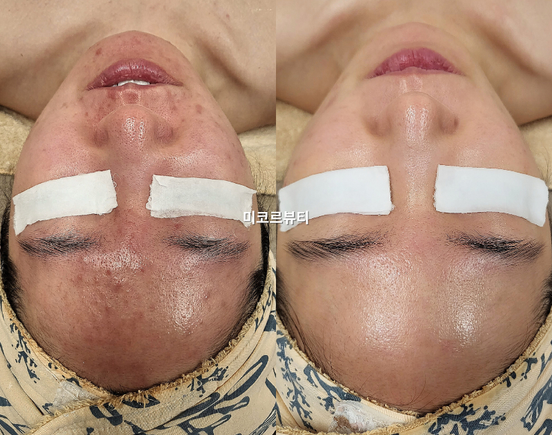 미코르뷰티 대표 이미지