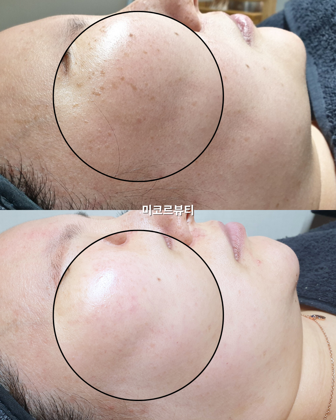 미코르뷰티 대표 이미지