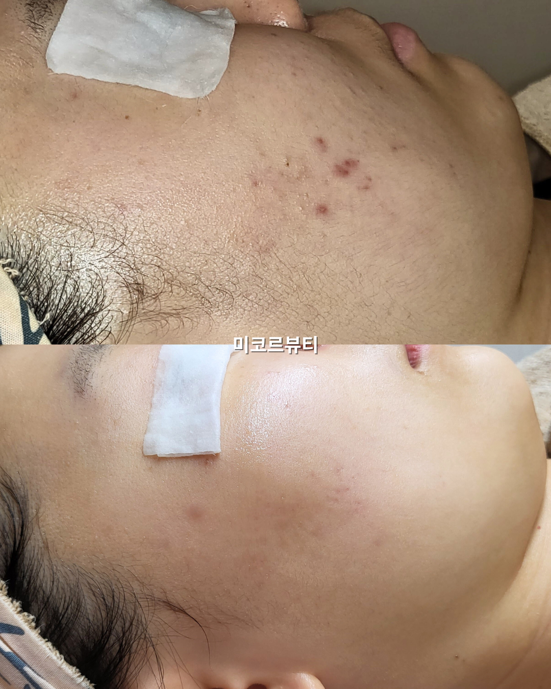 미코르뷰티 대표 이미지
