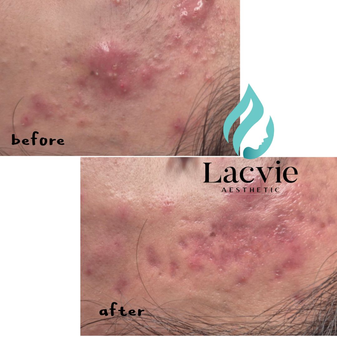 라크비 에스테틱 대표 이미지