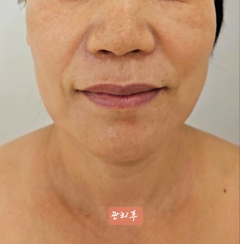 금손 대표 이미지