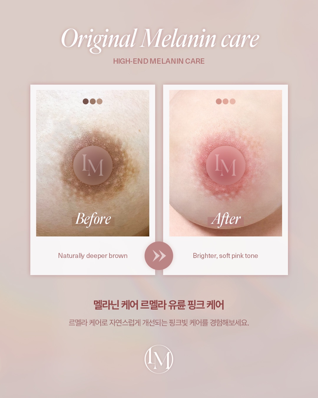 케이슬림 대표 이미지