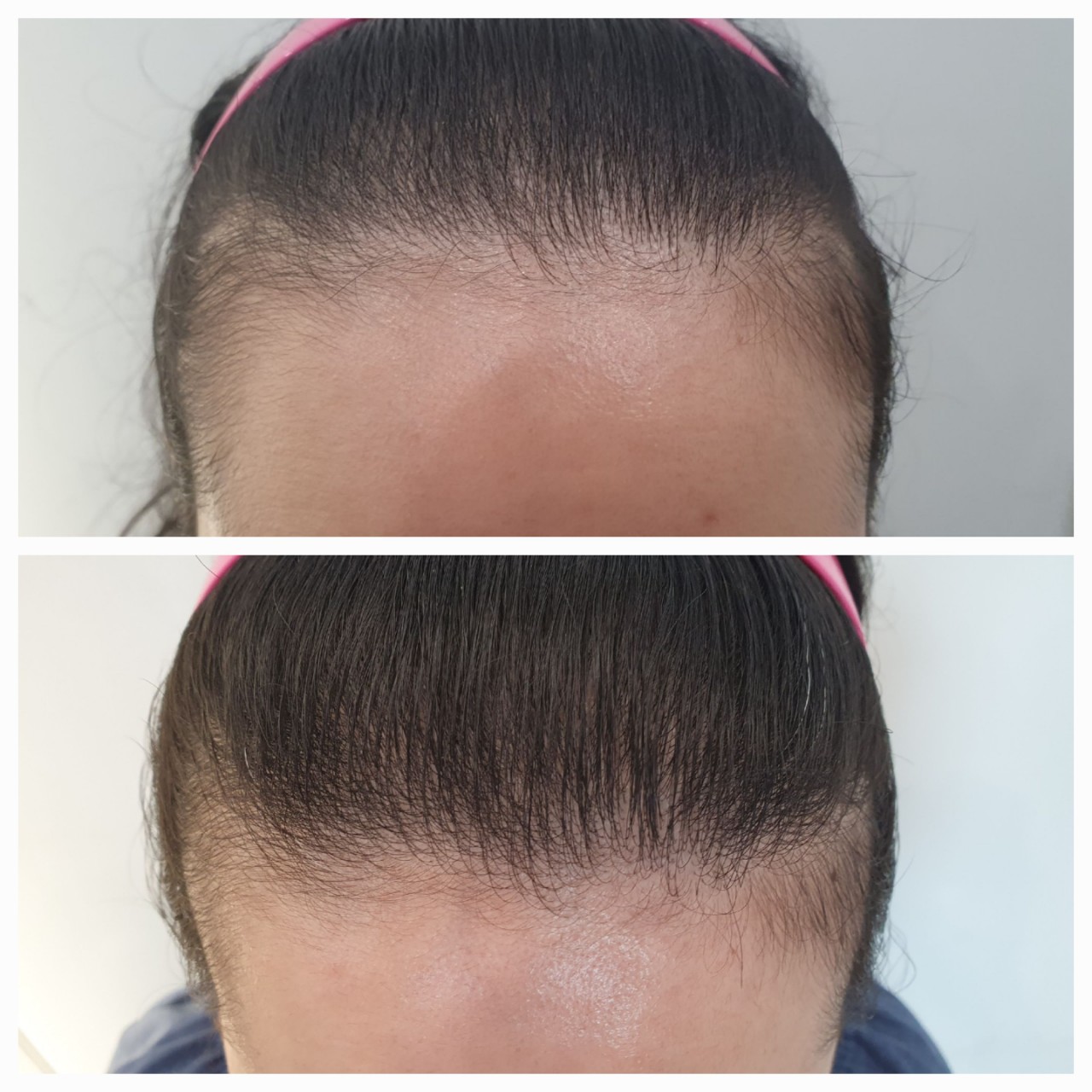 하니루비셀뷰티랩 불광점 대표 이미지