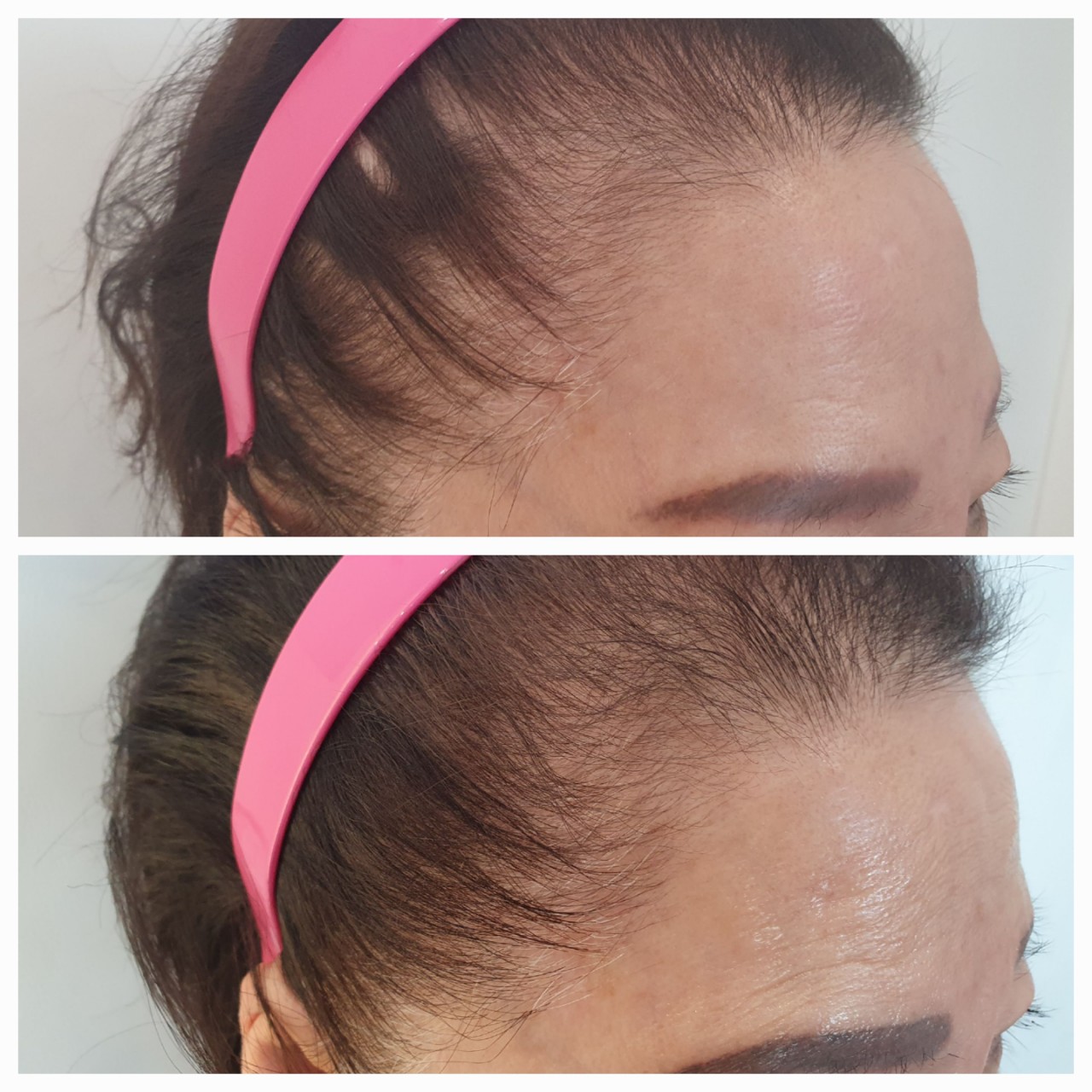 하니루비셀뷰티랩 불광점 대표 이미지