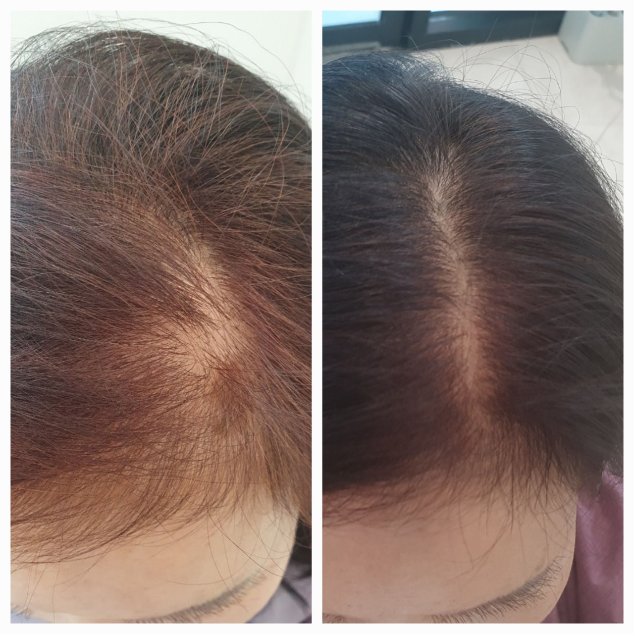 하니루비셀뷰티랩 불광점 대표 이미지