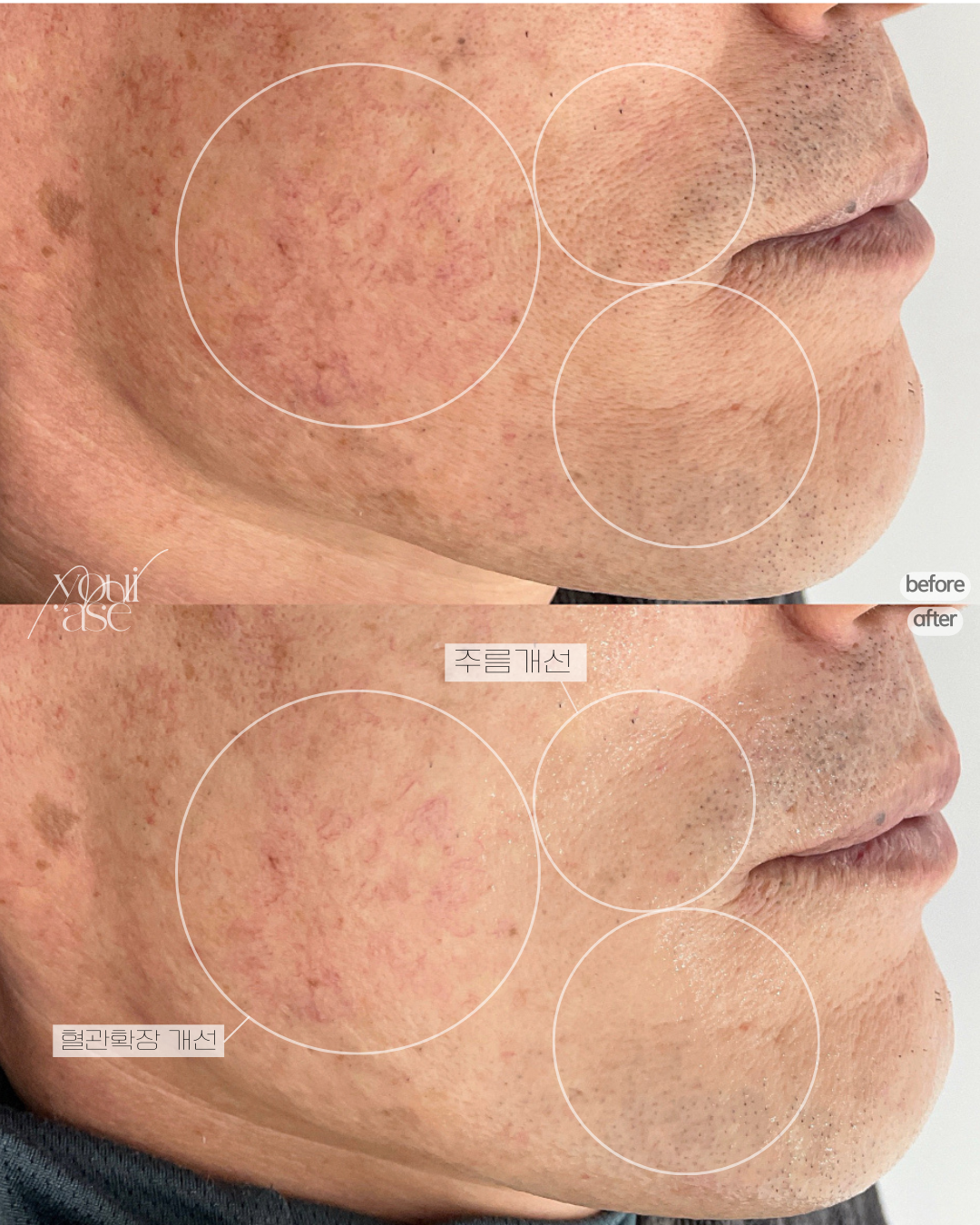 요이에스테틱 대표 이미지