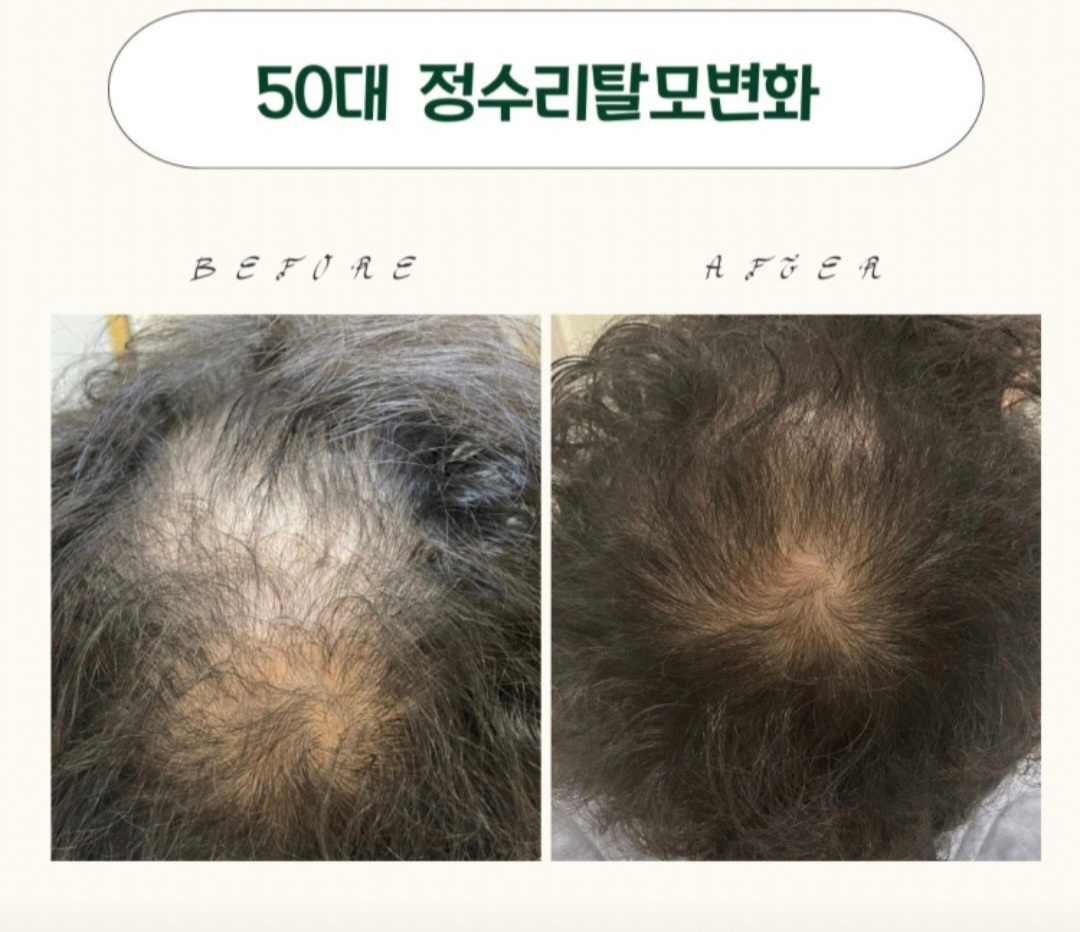 라파스칼프 서산점 대표 이미지