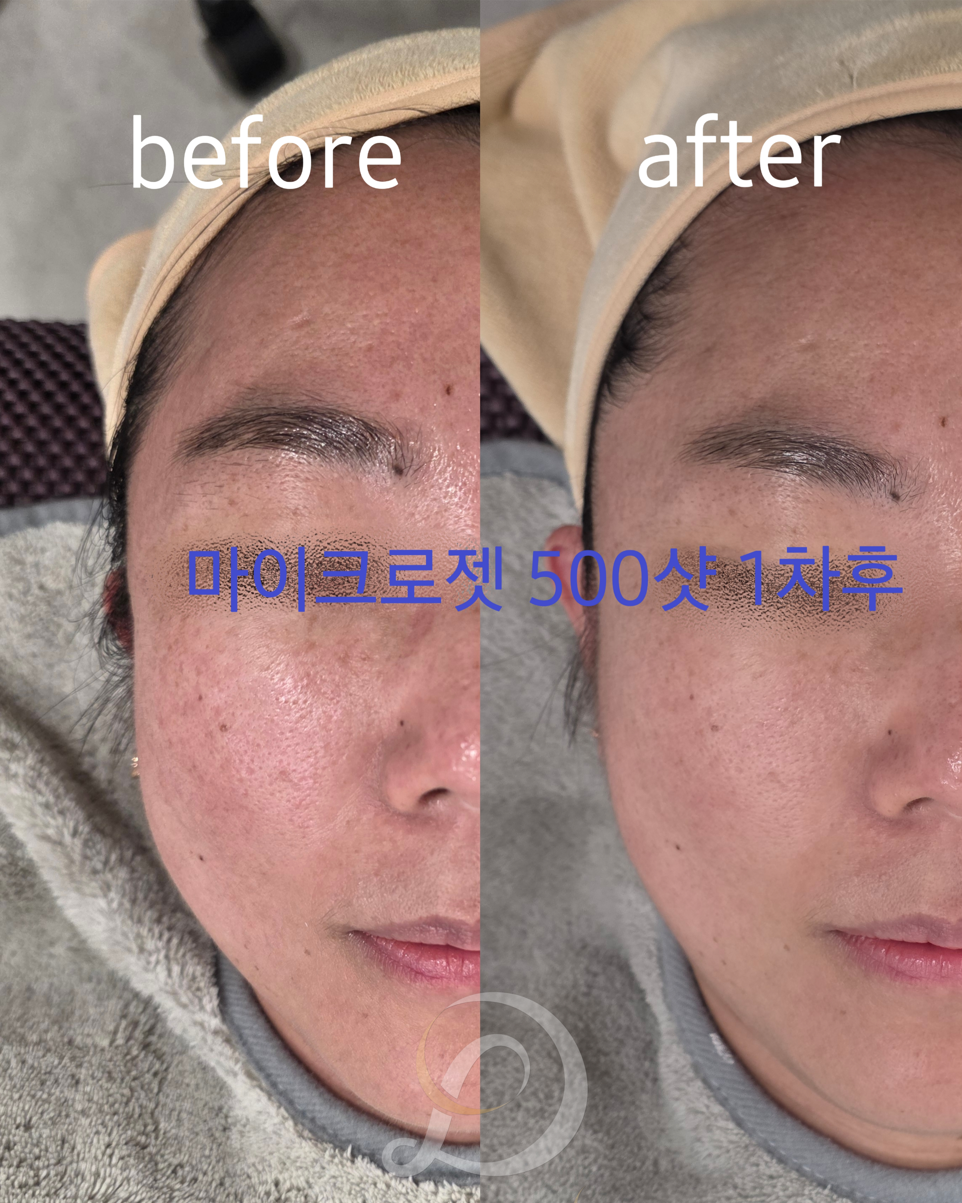 린다아이래쉬 photo 4
