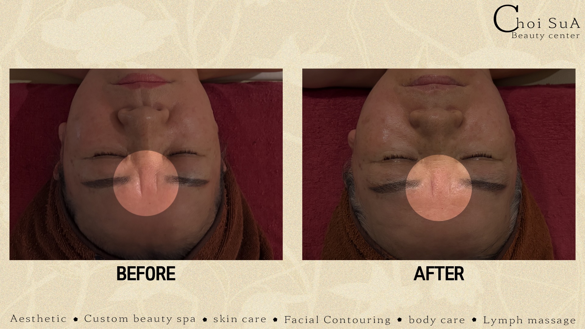 최수아뷰티센터 로비 이미지
