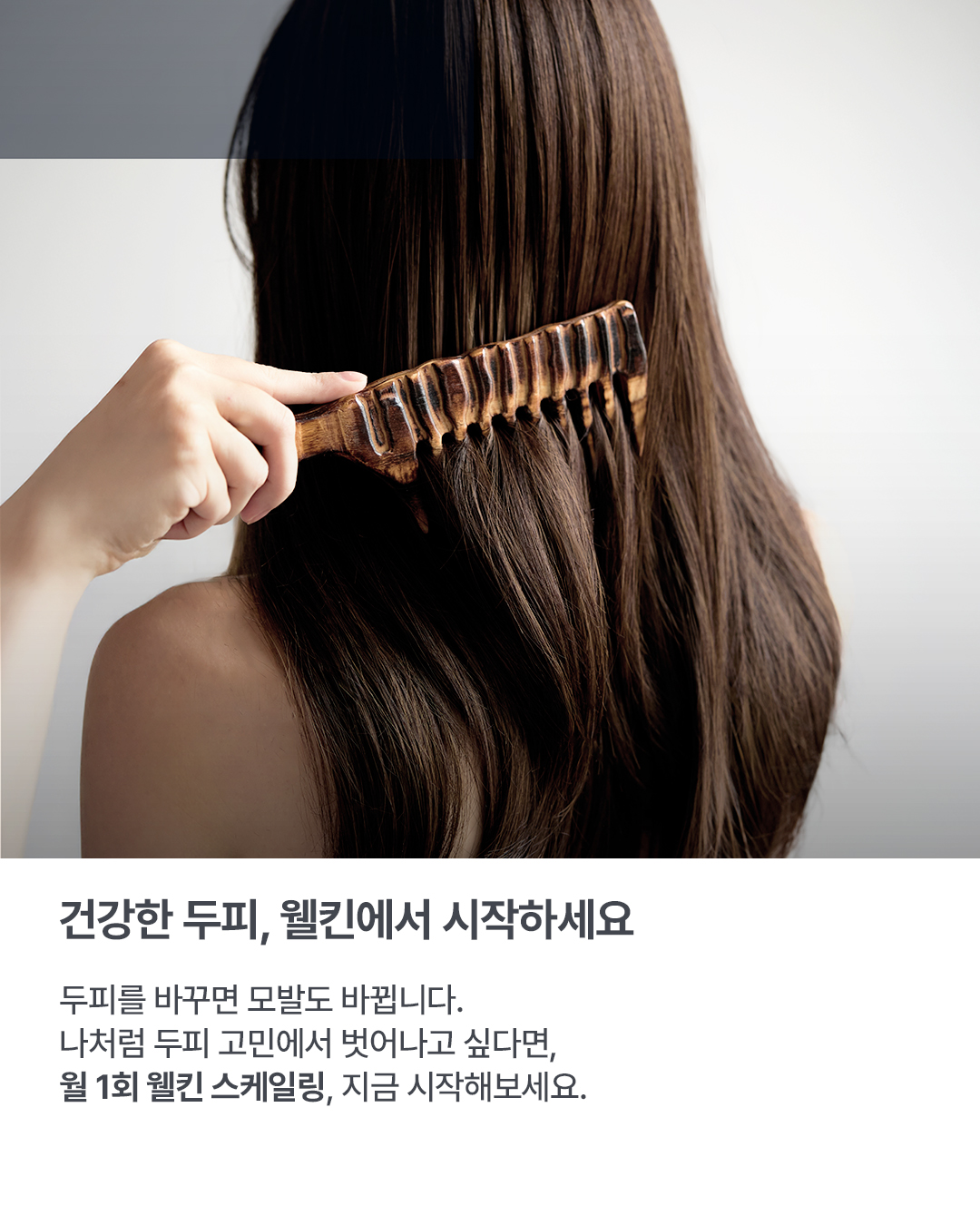 웰킨 두피탈모센터 종로점 대표 이미지