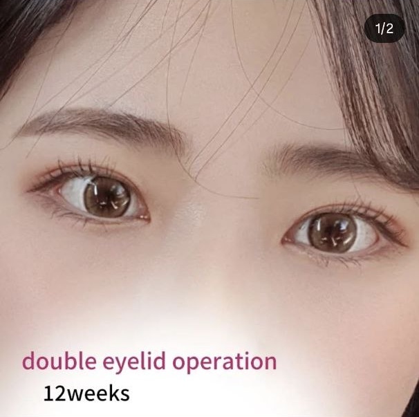 PR성형외과 대표 이미지