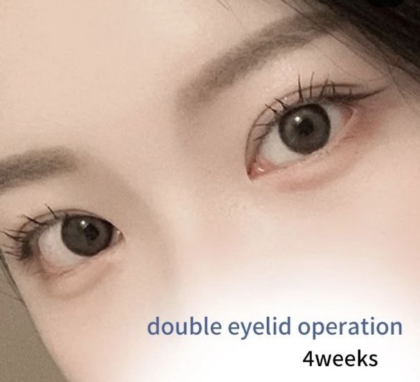 PR성형외과 대표 이미지