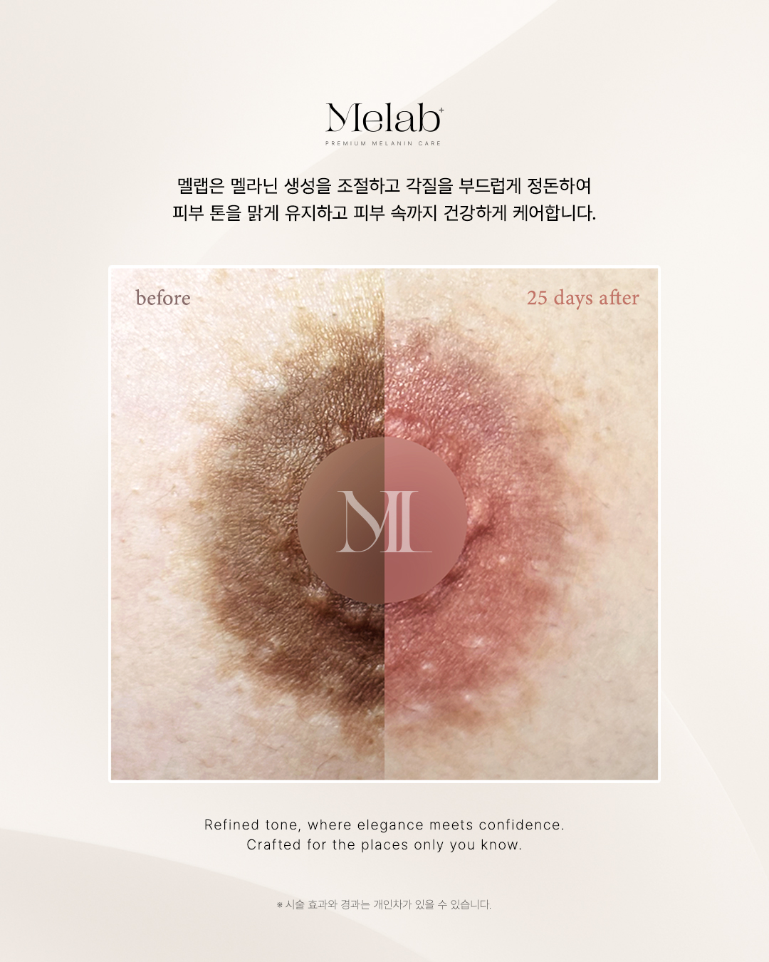 미엘리뷰티 대표 이미지